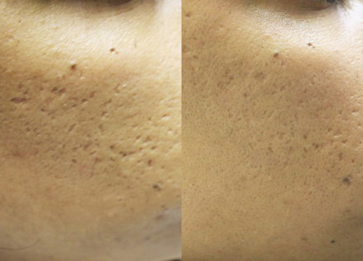 beforeafter3b